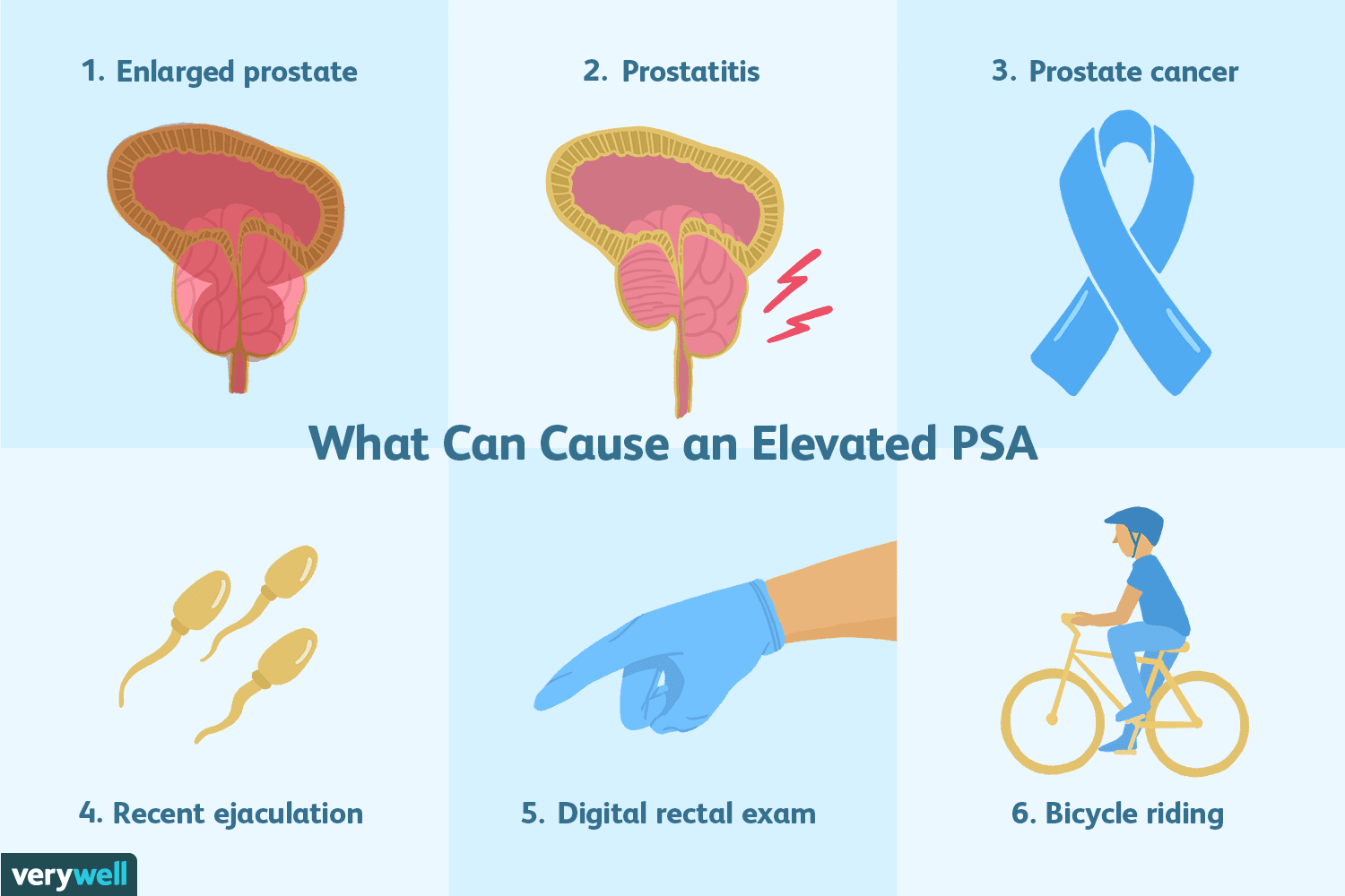 PSA blood test report being reviewed